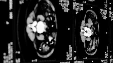 Best Diagnostic Imaging Techniques for Using AI in Medical Diagnosis