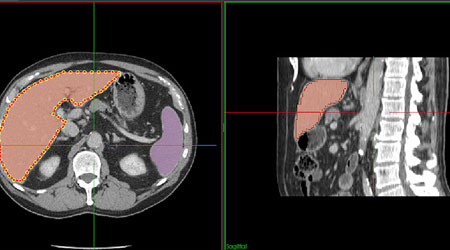 What are X-Ray and CT Scan Technology?