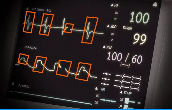 Waveform Annotation 